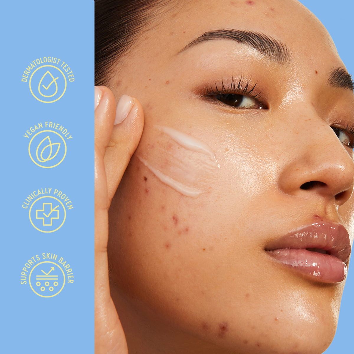 Blemish Acne Control Moisturizer
