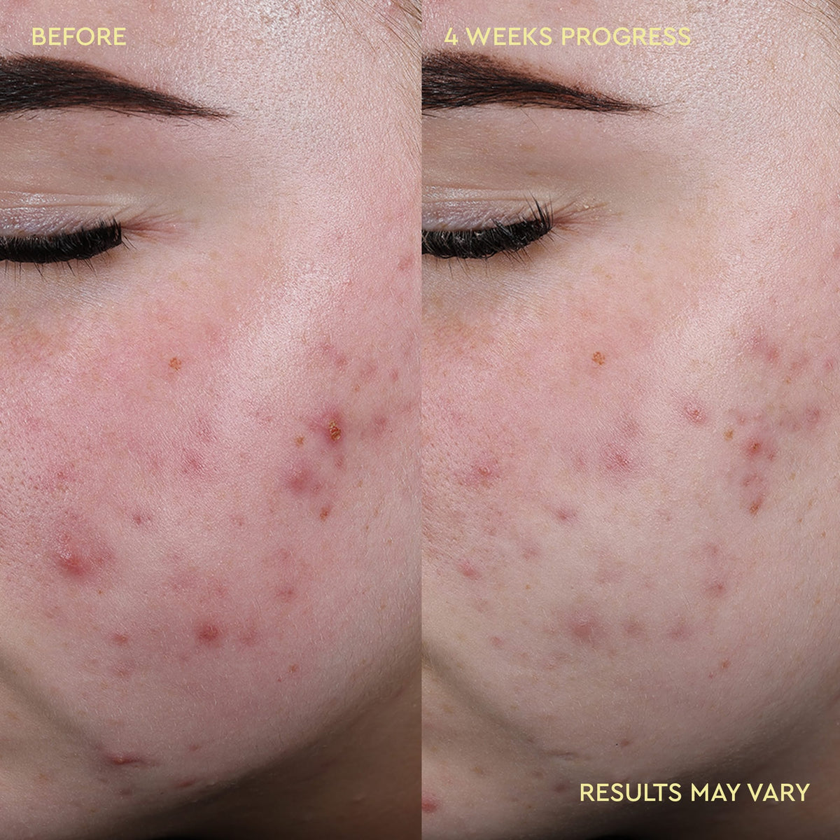 Blemish Redness Relief Soothing Toner